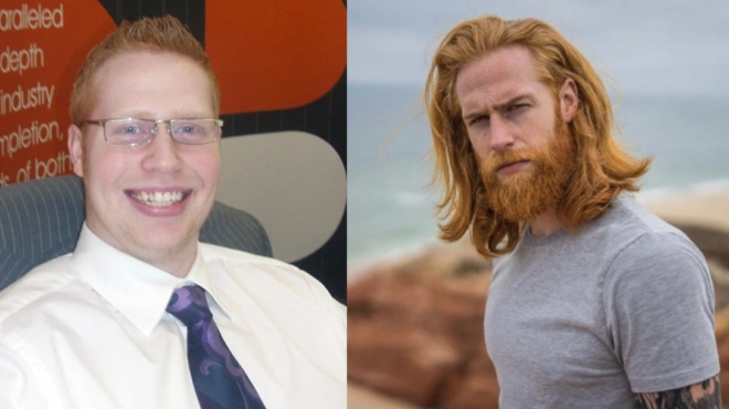 petaxe-ta-gyalia-echase-kila-kommotis-toy-proteine-na-afisei-moysi-kai-simera-einai-perizitito-montelo-34337