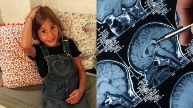 i-spania-morfi-karkinoy-ston-egkefalo-poy-kostise-tin-zoi-stin-mikri-anastasia-oi-aities-kai-ta-symptomata-64491