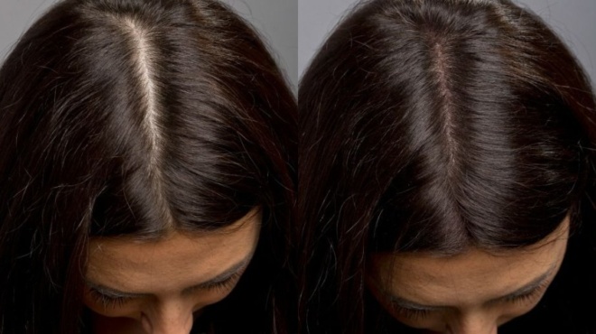 7-trofes-kata-tis-trichoptosis-poy-tha-xanakanoyn-ta-mallia-sas-dynata-kai-makria-me-fysiko-tropo-70426