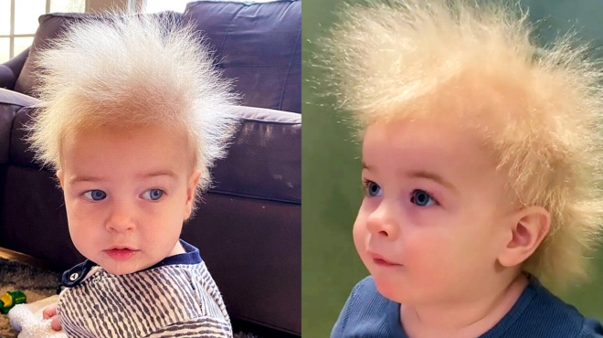 agori-6-eton-den-mporei-na-chtenisei-ta-mallia-toy-logo-spanioy-syndromoy-kai-egine-i-1i-firma-sto-instagram-5402