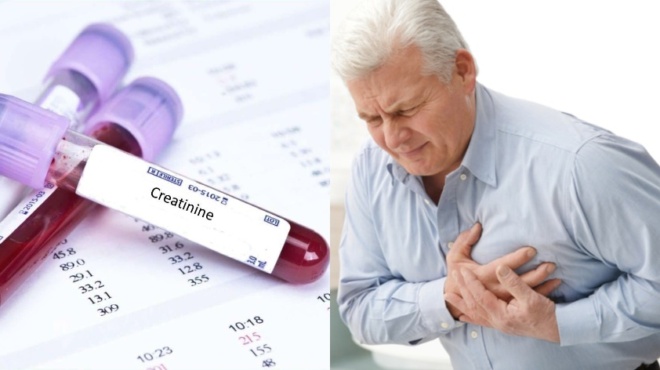 kinasi-kreatinis-poies-oi-fysiologikes-times-amp-8211-ti-deichnei-gia-tin-ygeia-i-ayxisi-kai-i-meiosi-tis-38915