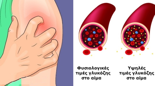 diavitis-ti-symvainei-otan-to-sakcharo-einai-ektos-orion-amp-8211-7-krisima-symptomata-amp-8211-pote-prepei-na-pate-ston-giatro-75413