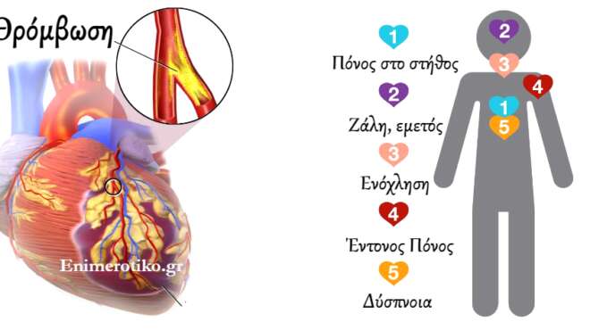 emfragma-amp-8211-kardiaki-prosvoli-poia-ta-symptomata-amp-8211-ti-prepei-amesos-na-kanoyme-89892