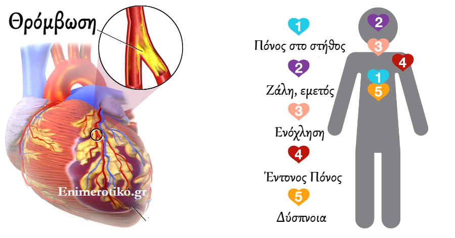 Έμφραγμα – Καρδιακή Προσβολή: Ποια τα συμπτώματα – Τι πρέπει αμέσως να  κάνουμε | Enimerotiko.gr