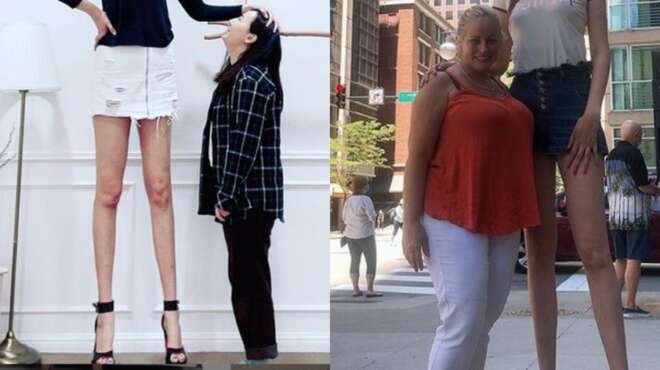 einai-29-eton-echei-ta-psilotera-podia-sto-kosmo-kai-afinei-toys-antres-me-to-stoma-anoichto-94482