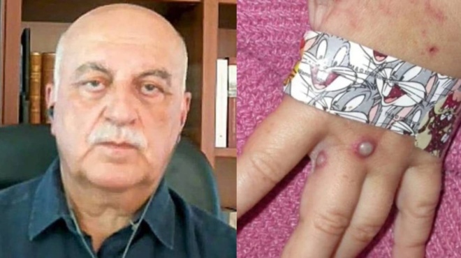 eylogia-ton-pithikon-amp-8211-tzanakis-pposochi-sta-cheria-ta-roycha-kai-kalo-psisimo-sto-kreas-poy-trome-37267