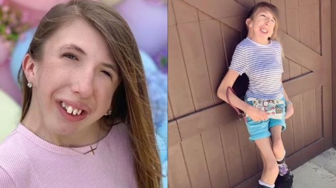 14chroni-me-spania-pathisi-echei-antexei-33-cheiroyrgeia-kai-i-asfalisi-tis-den-kalyptei-kamia-therapeia-46213