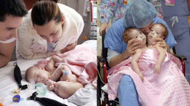 gennithikan-me-kollimenes-tis-kardies-toys-kai-simera-einai-2-panemorfes-efives-poy-giortazoyn-10-chronia-diachorismoy-72419