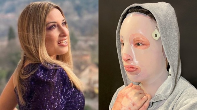 ioanna-paliospyroy-oi-eikones-me-ta-rasa-kai-ta-aimata-me-sokaran-eniosa-tachykardia-67198