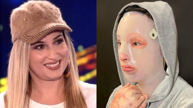 ioanna-paliospyroy-se-eidiko-kentro-apokatastasis-sti-gallia-amp-8211-eimai-poly-enthoysiasmeni-62836