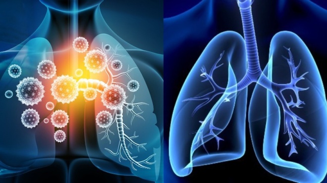 koronoios-i-vitamini-poy-thorakizei-toys-pneymones-apo-ioys-kai-mikrovia-kai-poies-trofes-tin-periechoyn-42690