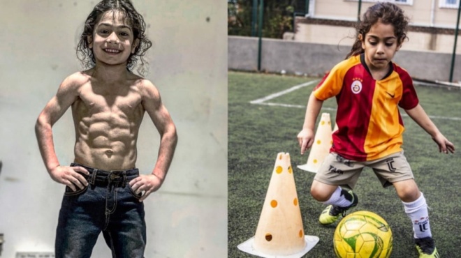 mikroskopikos-hulk-8chronos-me-exopragmatikoys-koiliakoys-amp-8220-trelainei-amp-8221-to-diadiktyo-amp-038-theoreitai-o-mellontikos-mesi-90