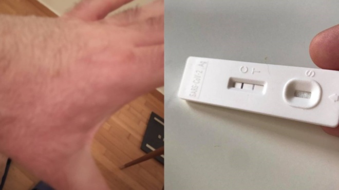 omikron-4-5-auta-eivai-ta-simadia-sto-derma-poy-fonazoyn-oti-kollises-kai-as-deichnei-to-test-arnitiko-21442