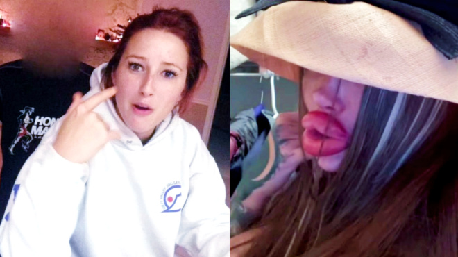 panemorfi-25chroni-ethistike-stis-plastikes-evale-cheilia-aytia-kai-tepastia-emfyteymata-kai-egine-san-tepas-52853