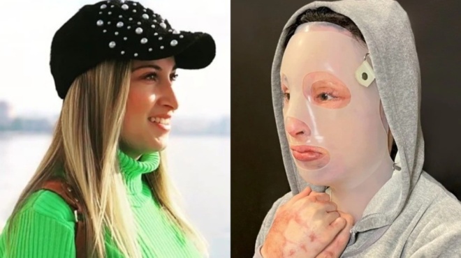 plastiki-cheiroyrgos-ioannas-to-prosopo-tis-den-tha-einai-pote-xana-to-idio-amp-8211-i-efi-eiche-emmoni-mazi-tis-35534