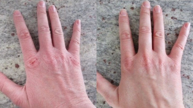 5-polytima-tips-gia-na-echeis-apala-cheria-olo-to-cheimona-56312