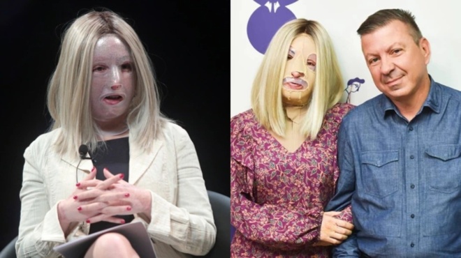 sygklonizei-o-psychiatros-tis-ioannas-paliospyroy-antimetopisa-enan-anthropo-choris-prosopo-79100