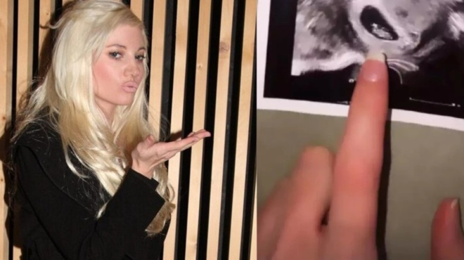 tzoylia-alexandratoy-o-giatros-eipe-oti-to-mopo-moy-einai-poly-omorfo-sto-vinteo-8583