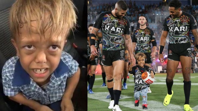 i-kalyteri-mera-tis-zois-toy-ena-olokliro-gipedo-cheirokrotei-ton-9chrono-me-nanismo-poy-epese-thyma-mpoylingk-49672