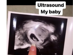 Τζούλια Αλεξανδράτου