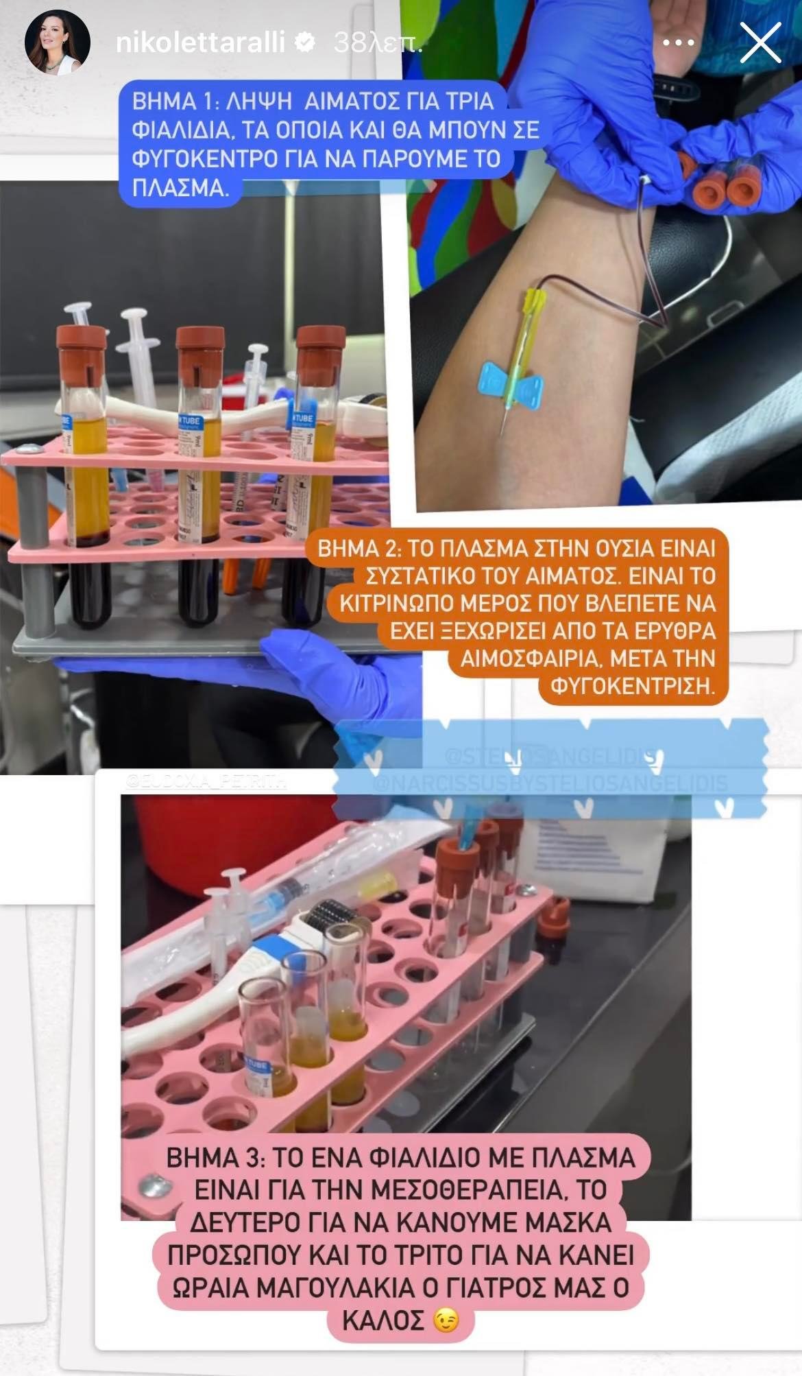 Νικολέττα Ράλλη επιδερμίδα