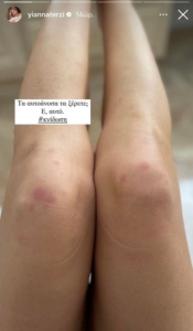 Γιάννα Τερζή