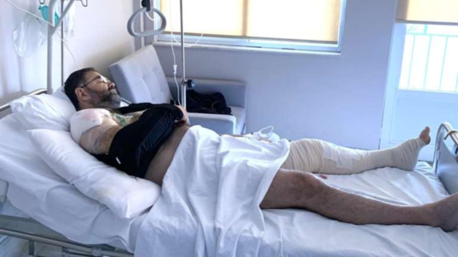 epapsa-na-echo-cheri-itan-ena-kremasmeno-kommati-kreas-pano-moy-i-tragiki-symptosi-me-ton-stayro-mpalaska-160513