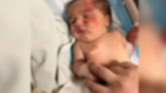 amp-8220-ragizei-amp-8221-kardies-adespotos-skylos-esose-moro-poy-egkateleipsan-sta-skoypidia-202332