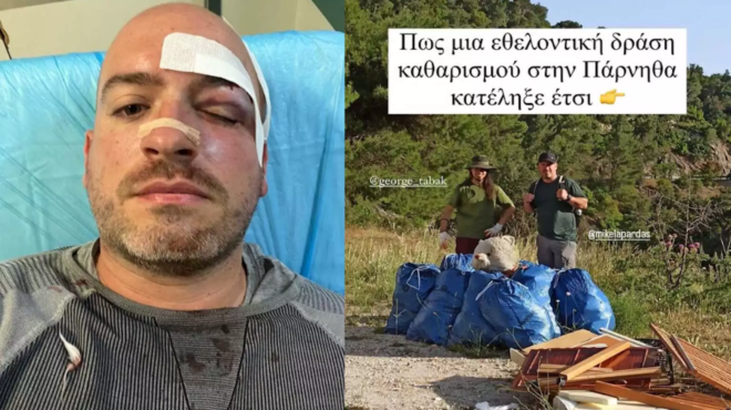 parnitha-xylokopisan-ethelontes-poy-katharizan-to-dasos-amp-8211-amp-8220-echoyme-synantisei-ola-ta-zoa-mono-o-anthropos-mas-evlapse-amp-8221-263289