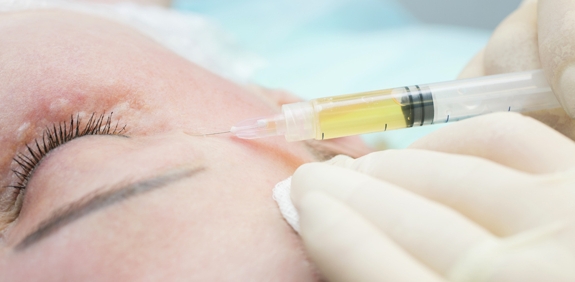 Μπότοξ στο μισό πρόσωπο