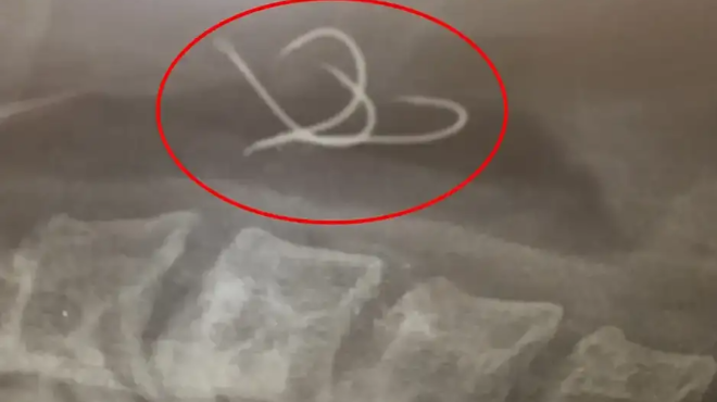 sok-gia-38chrono-agrinio-psarepse-ena-chtapodi-ki-otan-pige-na-to-faei-amp-8230-kontepse-na-pethanei-amp-8211-kopike-i-anasa-moy-evala-to-dachtylo-mesa-kai-amp-8230-360515