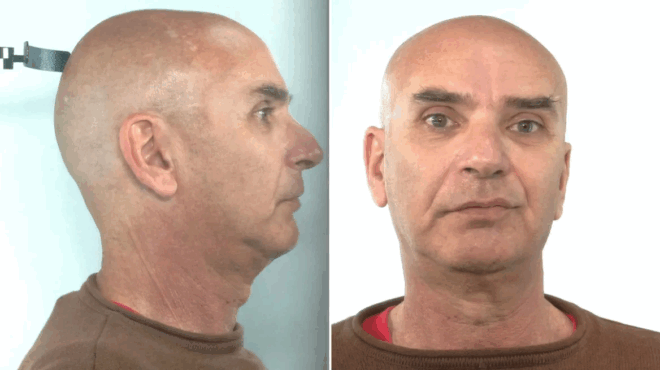 salamina-synelifthi-ergotherapeytis-poy-aselgise-se-aniliki-me-anapiria-371195