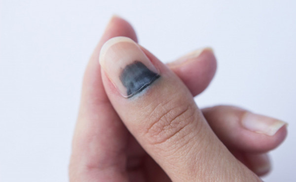 mayri-grammi-sto-nychi-to-simadi-poy-den-prepei-na-agnoiseis-amp-8211-i-sovari-pathisi-poy-deichnei-379415