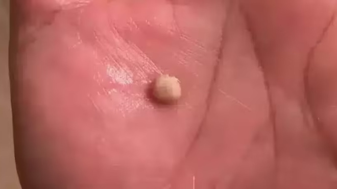 na-ti-prepei-na-gnorizete-gia-aytes-tis-petres-poy-emfanizontai-380714