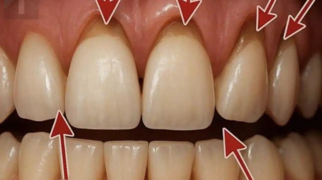 10-eykoles-spitikes-therapeies-gia-tin-anakoyfisi-apo-tin-astheneia-ton-oylon-377165