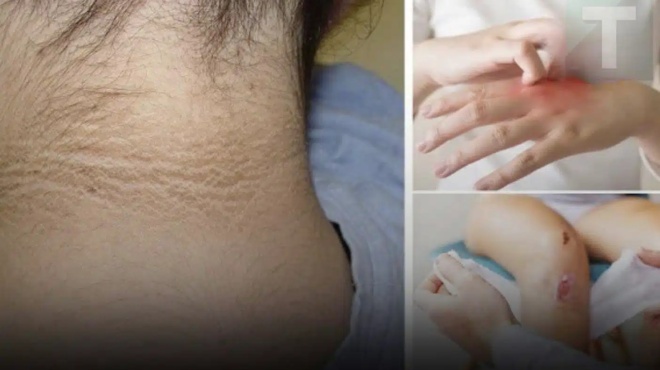 otan-to-soma-echei-ta-5-auta-symptomata-mporei-na-simainei-oti-o-diavitis-echei-ftasei-sto-teliko-stadio-381412