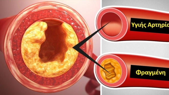 cholisteroli-to-katakokkino-froyto-poy-dialyei-ta-lipi-stis-artiries-dra-se-60-377812