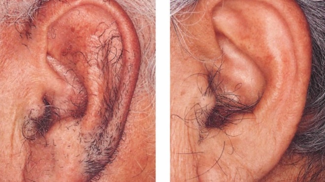 na-giati-megalonoyn-triches-sta-aytia-sas-389538