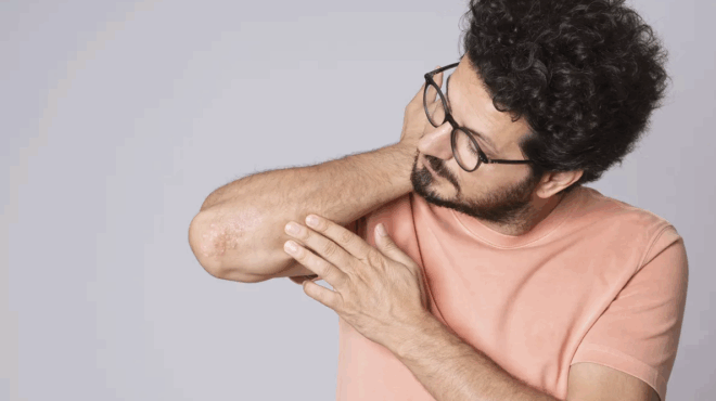 echeis-psoriasi-ki-omos-yparchei-mia-vitamini-poy-amp-8230-tin-exafanizei-amp-8211-kanei-thaymata-sto-derma-sas-384206