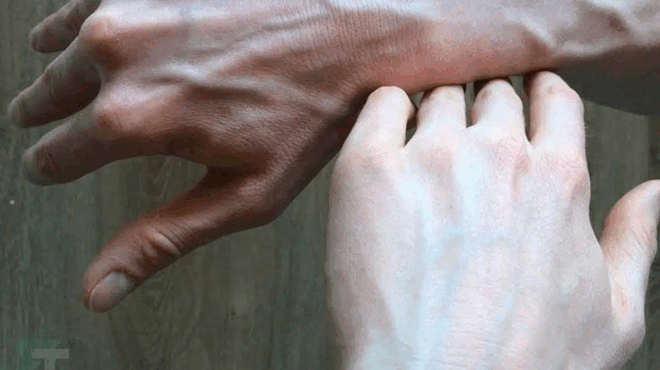 an-deite-kapoion-me-diogkomenes-fleves-prepei-na-toy-peite-ayta-ta-pragmata-385578