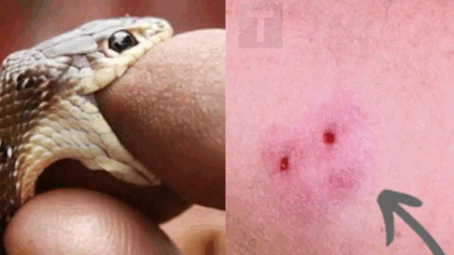 an-sas-dagkosei-dilitiriodes-fidi-einai-asfales-na-royfixete-tin-pligi-me-to-stoma-sas-385669