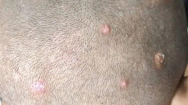 vrika-ayta-sto-kranio-toy-gioy-moy-ti-prepei-na-kano-383273