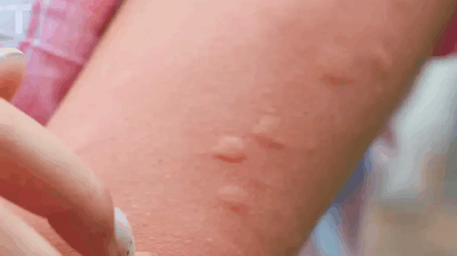 i-giagia-moy-emathe-ayto-to-kolpo-gia-na-apallago-apo-ta-tsimpimata-koynoypion-mesa-se-dyo-2-lepta-me-0-prospatheia-na-pos-ginetai-387469