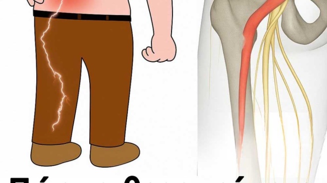 3-askiseis-gia-tin-anakoyfisi-apo-ton-ischialgiko-pono-sto-podi-praktikes-kai-apotelesmatikes-390231