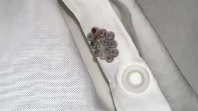 vrika-ayta-ta-mikroskopika-mpalakia-sto-krevati-moy-kai-schedon-epatha-kapdiaki-pposvoli-386227