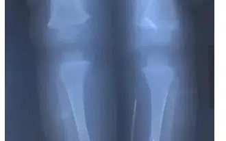 sok-trypoyse-me-velones-to-kormi-toy-moroy-tis-gia-ton-adianoito-logo-398703