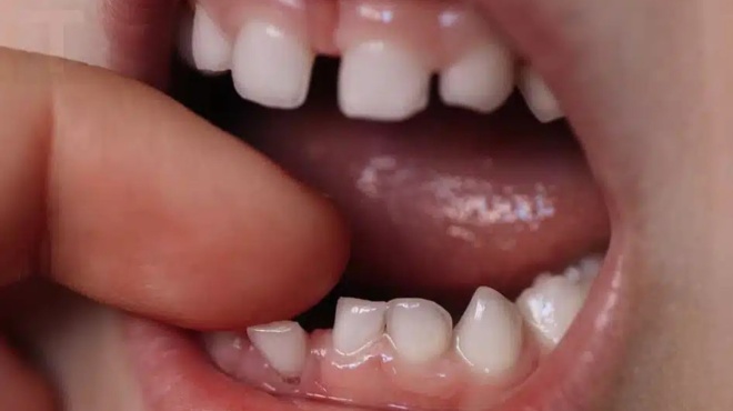 na-giati-oi-goneis-prepei-na-kratoyn-ta-neogila-dontia-toy-paidioy-toys-mporei-na-sosoyn-mia-zoi-394439