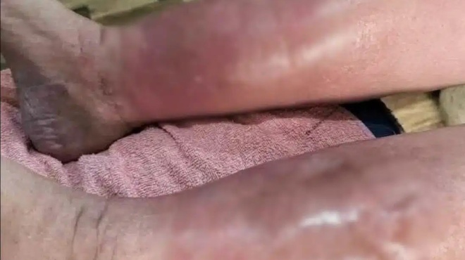 xekathara-symptomata-oti-ayto-einai-kap-amp-8230-394473