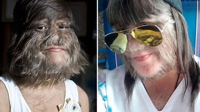 to-pio-trichoto-koritsi-sto-kosmo-xyristike-giati-vrike-ton-epota-tis-zoi-tis-394291