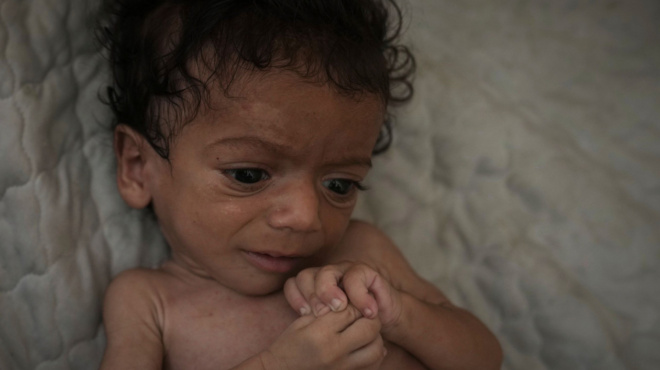 ektakti-eidisi-sok-amp-8211-epivevaiothike-to-cheirotero-senario-amp-8211-apeiloyntai-me-thanato-132-000-paidia-kato-ton-5-eton-406063